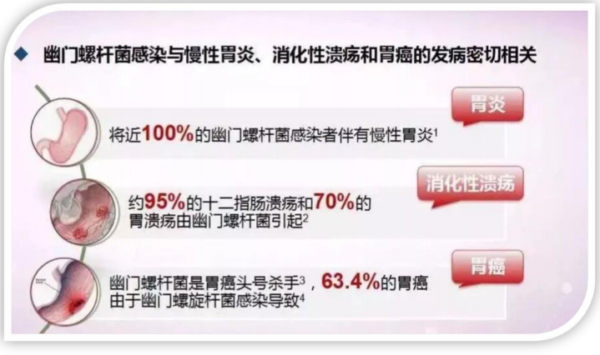 幽门螺杆菌发病率