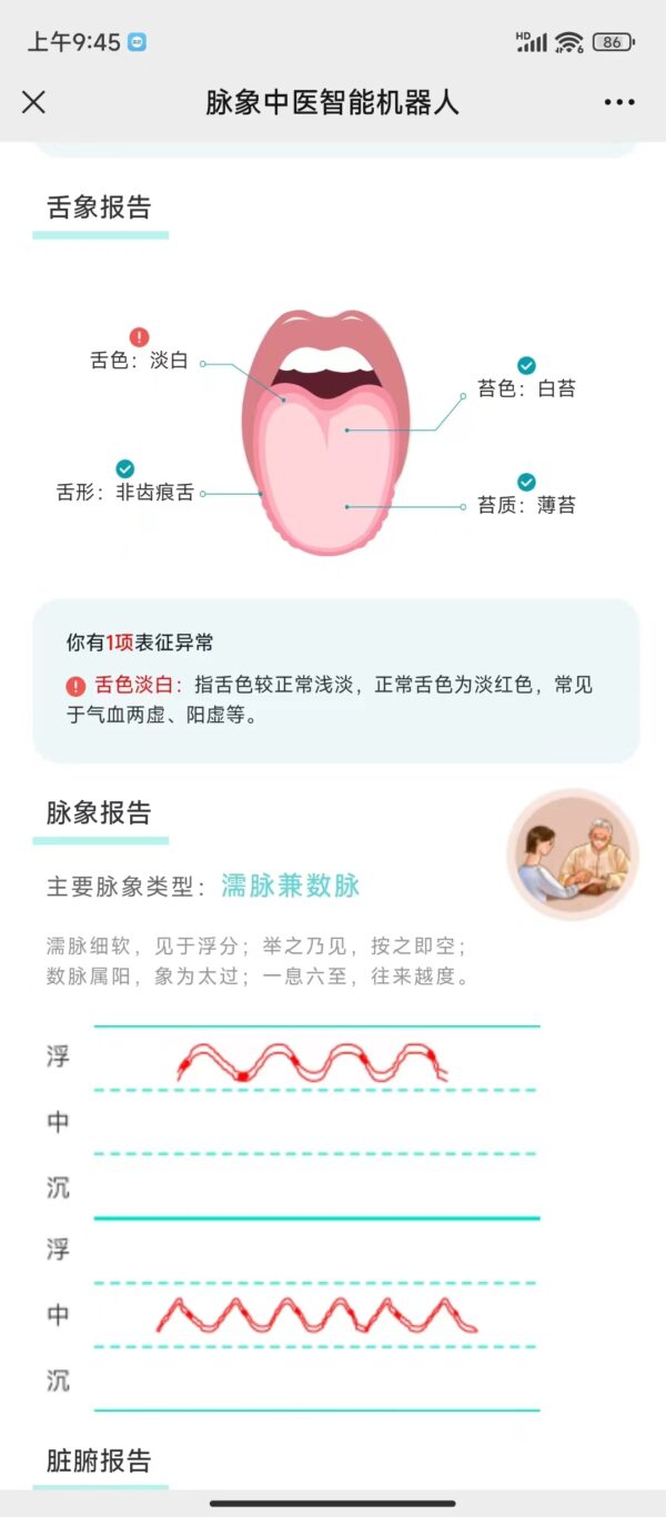 脉象中医中医智能机器人