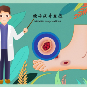 糖尿病神经病变，如不及时就医，恐病变为糖尿病足，严重的要截肢瘫痪