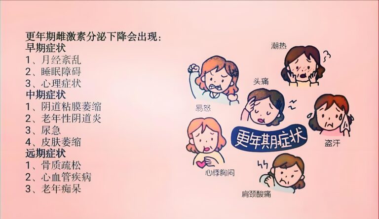 女性更年期症状